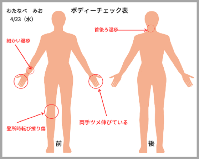 視診 とは子どもの心と体の様子を見分ける保育士の大切な仕事 視診 とは子どもの心と体の様子を見分ける保育士の大切な仕事